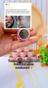 Salep flek LBY cream malam farma LBY bagus untuk flek jerawat dan mencerahkan
