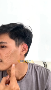 DR FAY Pudarkan Flek Hitam Dan Bekas Jerawat RESMI BPOM | ORIGINAL BEAUTYHACKS Krim Pemudaran Flek Hitam Perawatan Kulit Kering Gel Firming Dan Lifting - Lazada