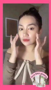 Jglow Paket Acne Extra Sulfur 5in1 Skincare Jerawat Aktif&Kulit Berminyak