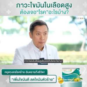 1 กล่อง Choles-X คลอเรสเอ็กซ์ ดูแลหัวใจ และหลอดเลือด ปรับระดับปัญหาไขมัน และไตรกลีเซอไรด์