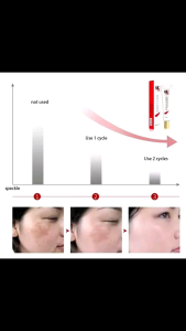 FLEK HITAM Cream Whitening Freckle Cream Remove Dark Spots Penghilang Flek Hitam / Jerawat / Bintik Noda Hitam Komedo