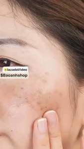 Kem 𝗦𝗶𝗲̂𝘂 𝗣𝗵𝗮̂̉𝗺 Nám MH Beauty Spa 20gr Dưỡng Trắng Da