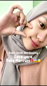 Zalfa Natural Moisturizer 30 Gram: Rahasia Memperbaiki Barrier Kulit