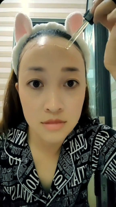 Serum Black rose Siêu cấp ẩm ( Hồng Tâm cosmetics)