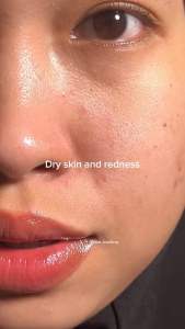 [Kulit Berjerawat] 50ML The Originote Cica-B5 Soothing Moisturizer - Moisturizer Menenangkan kulit Kemerahan Mengunci hidrasi with Centella Asiatica