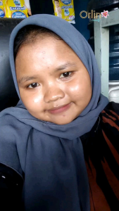 Paket Flek Skincare Orlin Beauty + Serum Rejuvenation / Paket Glowing / Flek Bandel Pudar