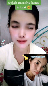 Chayra Perfect Skin Barrier / Krim Penetralan Wajah bpom