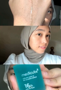 Serum Medicube Azelaic Acid 16 BB Calming 30 ml – Giảm Mụn Đỏ Mờ Thâm & Làm Dịu Thoáng Lỗ Chân Lông