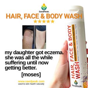 SeedPeak Eczema Citrus (S) Mini Travel Combo Set | Head to Toe Natural Body Shampoo (30ml) SOS Cream (5mlx2) Lotion (15ml)| Orange Mandarin Yuzu | Itchy Sensitive Rashes Natural Shower Gel Sabun Gatal Kulit | Essential Body Wash Travel Kit | 沐浴露