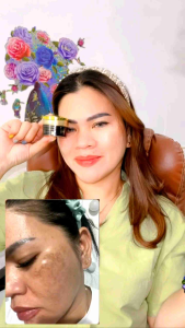 KEDAS BEAUTY - Gold Jelly 10gr Serum Perawatan Kulit