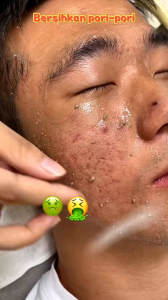 Gmeelan Exfoliating Gel Face Eksfoliasi Wajah Blackhead Cleaner Hydrating Gel With Niacinamide Improve Dull Skin