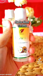 VICO OIL MINYAK KELAPA ASLI BEST SELLER ATASI BERMACAM PENYAKIT KULIT
