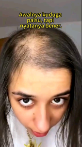 [FREE GIFT] REMIMPI SHAMPOO ANTI RONTOK DAN MEMPERCEPAT PERTUMBUHAN RAMBUT 300ML ORIGINAL