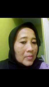 Orlin Beauty Paket Flek Platinum / Krim Flek Tebal & menahun/ Mencerahkan Wajah Mengencangkan Kulit / Skincare bpom ( free duoble gift cantik 🎁🎁)