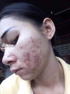 เซ็คหน้าใสพร้อมสวย 4 ชิ้น Me U Sun UV + ALOE VERA Cleansing Plus +  AloeVera + B-TA Gold serum - ไอออร่า IAURA iaura