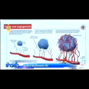 เปลี่ยนเป็นปัจจุบัน: โปร 5 แถม 1 เอมมูร่า ผลิตภัณฑ์เสริมอาหาร จากสารสกัดจากงาด เซซามิน ของแท้ 100%