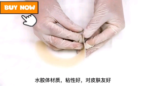 [10pcs] Medical High Grade Stoma Bag Elastic adhesive tape adhesive Strip fixed tape for Colostomy BAGS OSTOMY CARE