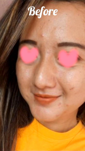 BOOSTER UP BY GLAMSHINE: CREAM PEMUTIH & PENGHILANG FLEK