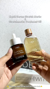 Clara Stretchmark Treatment Oil 100ml