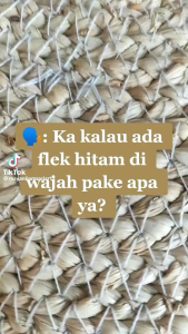 Sabun Wajah Untuk Plek Hitam, Bintik Hitam & Kulit Kusam