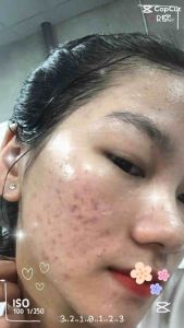 Combo 3 Sản Phẩm Thảo Mộc Thiên Nhiên - Tái Tạo Làn Mới Dành Cho Tất Cả Mọi Làn Da