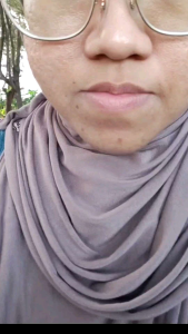 HOMEMADE ORGANIC LIP OIL SERUM MOISTURIZING REPAIR PINKY LIPS REBRAND JENAMA SENDIRI