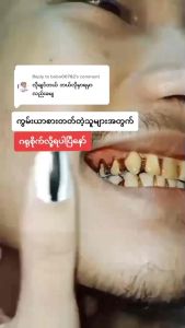 KHING KHING WHITENING TOOTHPASTE HERB