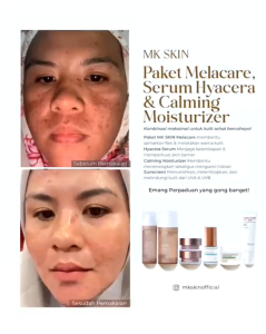 MKSKIN PAKET MELASMA FLEK HITAM BEKAS JERAWAT KUSAM BY MAHARANI KEMALA