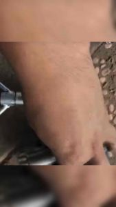 Treker Bearing Remuk Rusak Bahan Premium Universal Kualitas terbaik