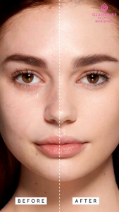 SKINCARE GLAMOURE BEAUTY BRIGHTENING SERIES & ACNE ORIGINAL BPOM