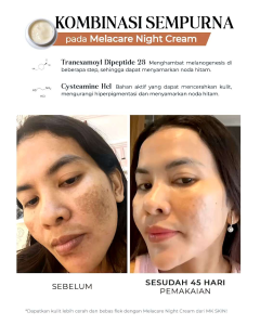 Paket Perawatan Skincare Mk Skin (Whitening Acne Melacare) By Mahari Kemala | Mencerahkan Wajah Memudarkan Berminyak