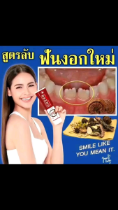 Ganoderma Lucidum 💯 % Asli Pasta Gigi ORI Penguat Gigi Goyang & Menyembuhkan Sakit Gigi Berlubang