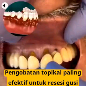GUM INSTANT Pemutih Gigi Pen Teeth Whitening Permanen / Gel Instan Perawatan Gusi & Mulut