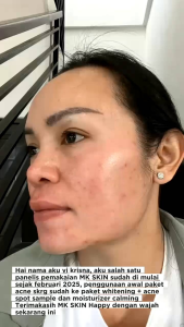 ORIGINAL BPOM MK Skin Paket Perawatan Wajah Lengkap – Sabun Cuci Muka Toner Krim Siang Malam & Sunscreen SPF50