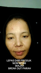 PAKET GLOW UP CRR BEAUTYSKINSKINCARE BPOM