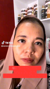 PAKET PREMIUM RETINOL By CRR Beautyskin