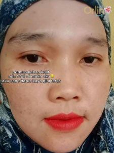 PAKET FLEK PLATINUM ORLIN BEAUTY SKINCARE MENCERAHKAN WAJAH BPOM