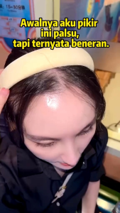 Remimpi Anti Hair Fall Hair Treatment Shampoo Oil Control Anti - dandruff Anti Hair LossAnti Rambut