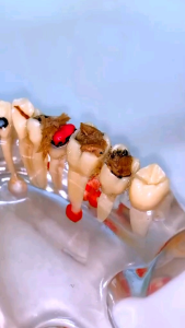 Dental Floss 50 pcs Macromolecul carea benang tusuk gigi Oral KOTAK