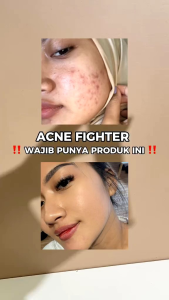 Reglow Double Action Acne Spot Gel: Solusi Jerawat dengan Salicylic Acid & Tea Tree Oil