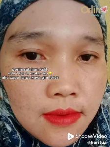 Paket Flek Platinum Orlin Beauty Skincare Mencerahkan Wajah BPOM