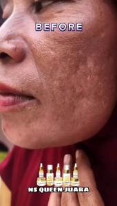 SKINCARE NS QUEEN PAKET PREMIUM PERAWATAN WAJAH