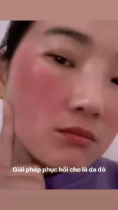 [Chính Hãng ] Serum phục hồi Da ZENEA TIMELESS GLOW SERUM 30ML- Cấp ẩm làm sáng  Chống nhăn hiệu quả - Nhạp Khẩu Hàn Quốc