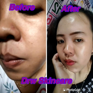 √100% ORIGINAL DRWSKINCARE paket komplit radiant acne brightening bekas jerawat FREE