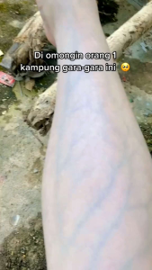 MUFAZKIN ORIGINAL BPOM HANDBODY PEMUTIH BADAN SUPER PREMIUM PALING CEPAT PUTIH HB WHITENING BOOSTER GLOW ORIGINAL DOSTING GLUTHATION & ALPHA ARBUTIN NIACINAMIDE PEMUTIH EXPRESS DOSIS TINGGI