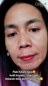 Orlin Beauty Paket Flek Tanpa Facial Wash 3in1 Mencerahkan Mengencangkan Kulit Wajah Memudarkan Flek Skincare BPOM