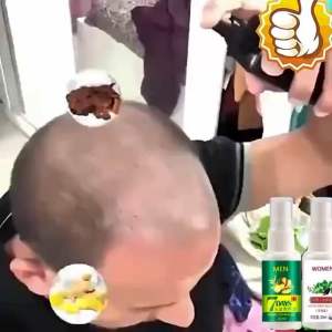 SPRAY HAIR TREATMENT MEN WOMEN pelebat rambut merawat rambut gugur tumbuhkan rambut