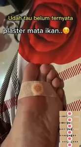 CORN PLASTER REMOVER 6Pcs Plaster ketuat kaki Tangan dan seluruh badan Buang kutil ketuat tahi lalat kulit mati mata ikan