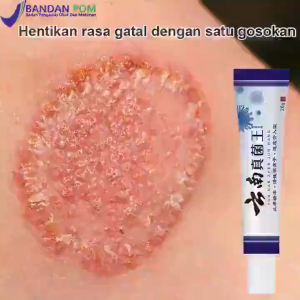 FootCare+ Foot Cream Krim Salep Kaki Anti Bau Anti Jamur Melembapkan Kulit Kering - BB052