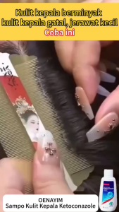 Dr March Ketoconazole Shampoo 2% Anti Ketombe & Jamur | Atasi Kulit Kepala Gatal Ketombe Membandel Rambut Rontok